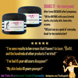 SHAKE IT - Scrub+Cream <br>*After (even DECADES after) pregnancy <br>*OR for anyone with scars/stretch marks, dry/ashy skin, loose skin, eczema <br>*OR just use as an everyday head-to-toe moisturizer! <br>*Anti-itch, organic, vegan, chemical-free
