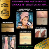 PERFECT POSTPARTUM package #1 - MAJOR discount! <br>*Shake It scrub+cream for stretch marks, tighter skin <br> *Plus Nip It for healing breastfeeding moms <br>*Anti-itch, organic, vegan, chemical-free