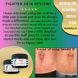 SHAKE IT - Butter cream <br>*After (even DECADES after) pregnancy <br>*OR for anyone with scars/stretch marks, dry/ashy skin, loose skin, eczema <br>*OR just use as an everyday head-to-toe moisturizer! <br>*Anti-itch, organic, vegan, chemical-free