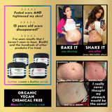 BAKE IT - Scrub+Cream<br>*SAVE BIG on a bundle!<br>*During pregnancy<br>*Can prevent new stretch marks while fading old ones! <br>*Anti-itch, organic, vegan, chemical-free